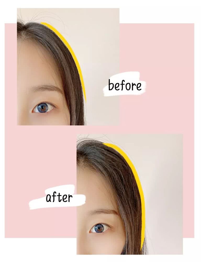 刘海油塌贴头皮怎么办,刘海油头发干枯