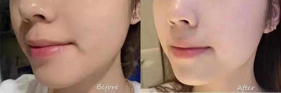 沈梦辰美妆精华,沈梦辰全靠这款精华液逆袭变白