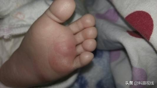 刚出生婴儿抢救无效死亡医生哭泣,刚出生的婴儿被抢救现状