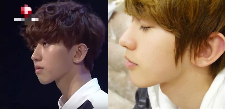 蔡徐坤整牙前图片,蔡徐坤整牙前后照片