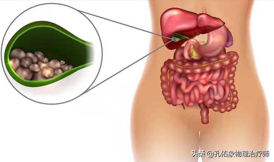 肩周炎肩膀疼痛用什么药,肩膀疼是肩周炎吗还是其他原因
