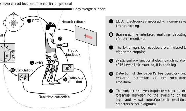 慢性截瘫患者康复取得重大临床突破：脑控+非肌肉侵入性刺激技术
