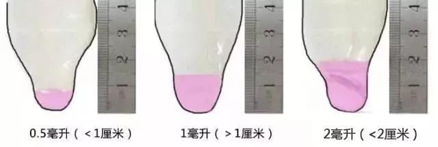 精子质量好坏标准,精子质量好坏看哪个值