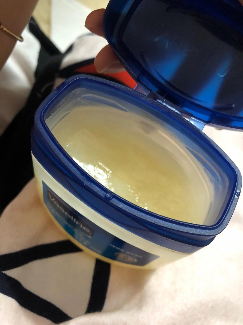 唇炎不痛不痒是什么唇炎,唇炎怎么治疗最有效慢性唇炎