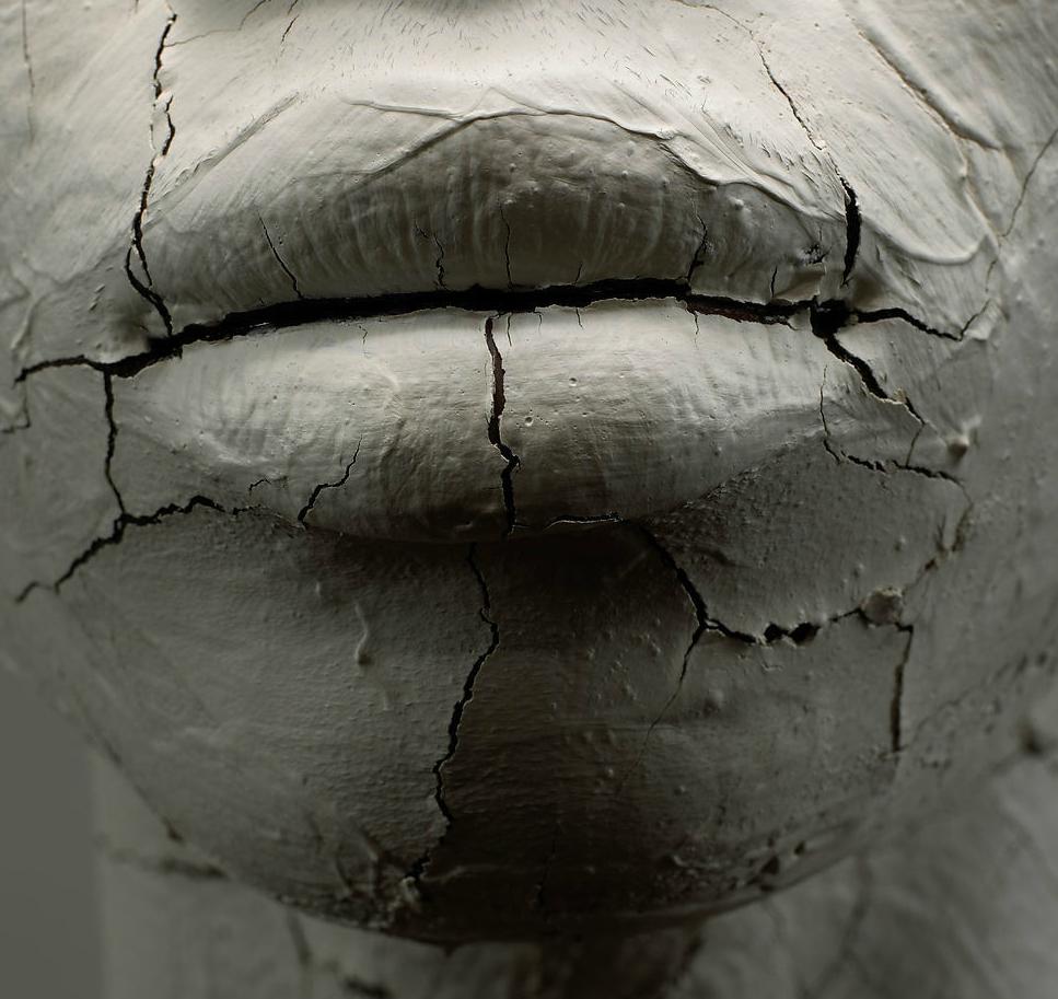 嘴唇干裂起皮怎么办教你一招解决,嘴唇干裂起皮教你一招解决