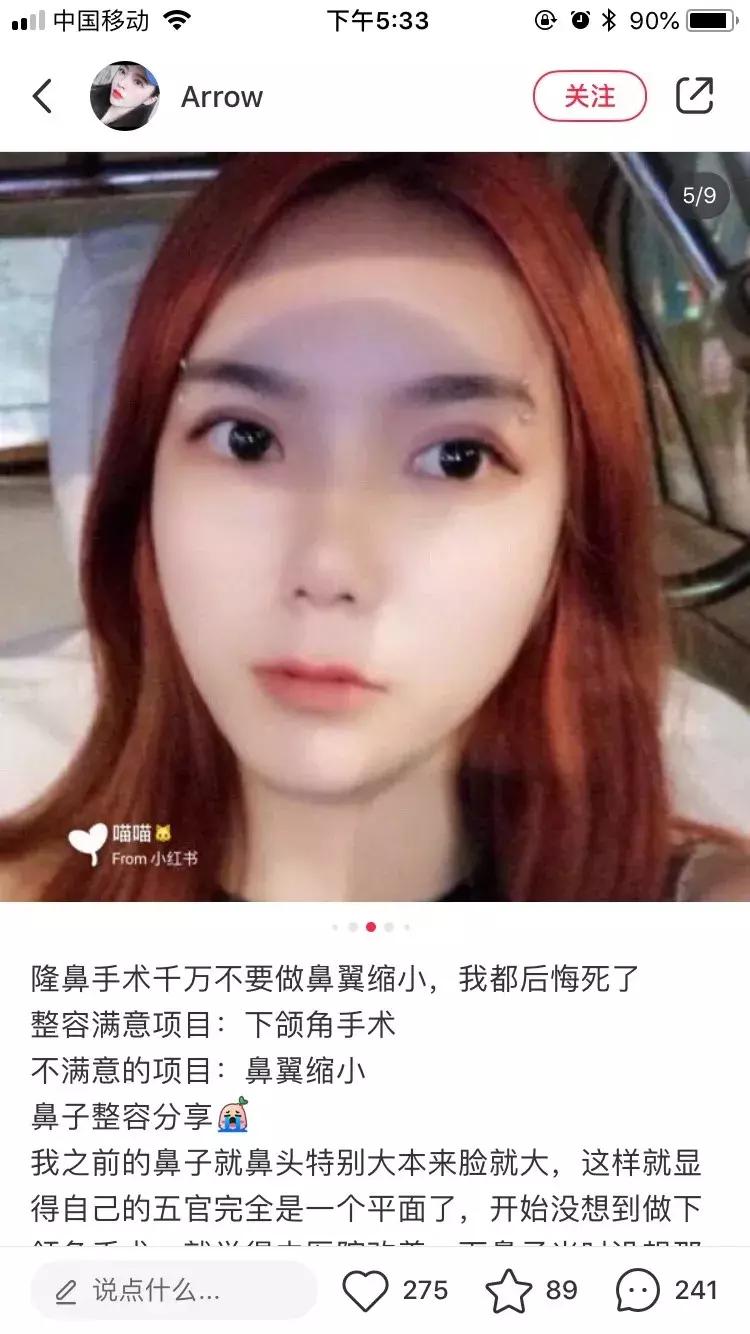 缩小鼻孔最简单有效的方法,怎么自由缩鼻孔