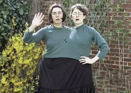 连体人一方去世,假如说有一个连体人去世了