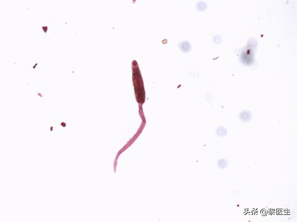 患有肝吸虫有什么症状,羊肝吸虫的征兆