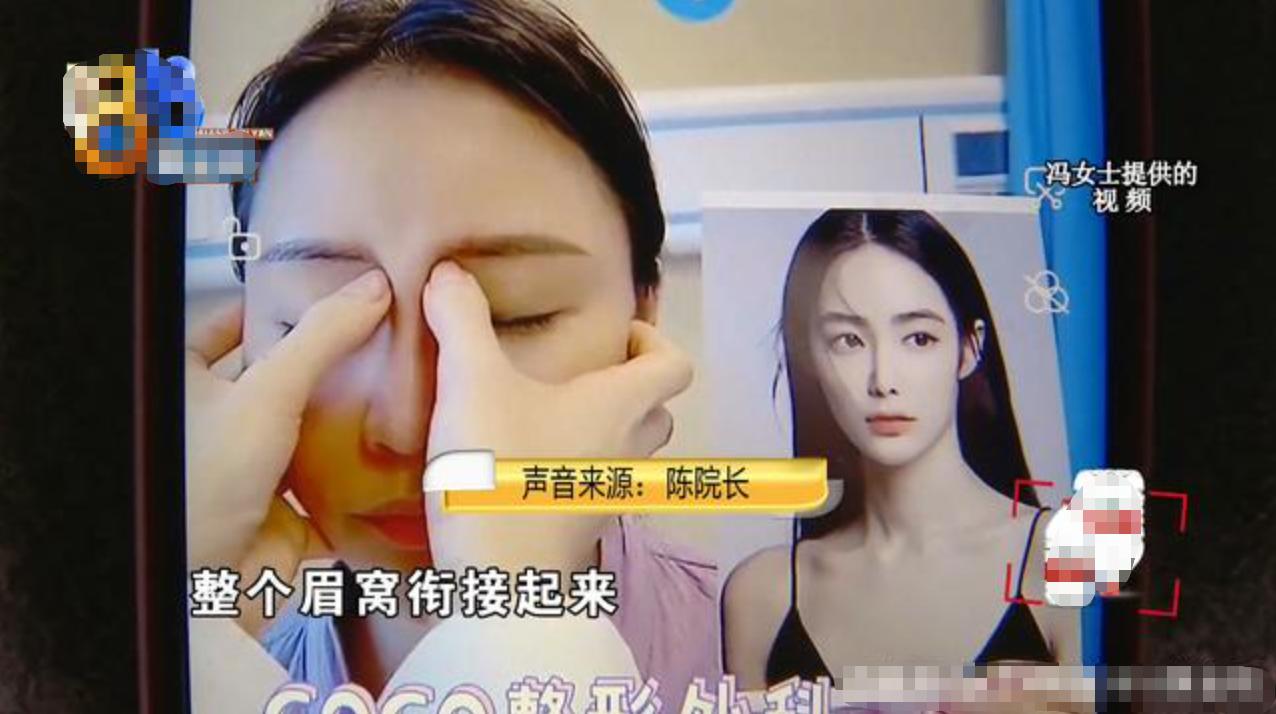 女子*款贷**整容直角鼻，鼻子被做歪，三位对接人员都离职了？