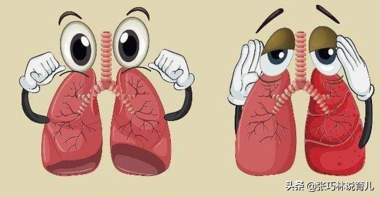 两岁宝宝肺炎支原体感染反复咳嗽,孩子得了支原体肺炎怎么去护理