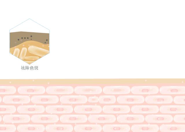 痘印痘坑真正祛除的方法,痘印痘坑去不掉怎么办