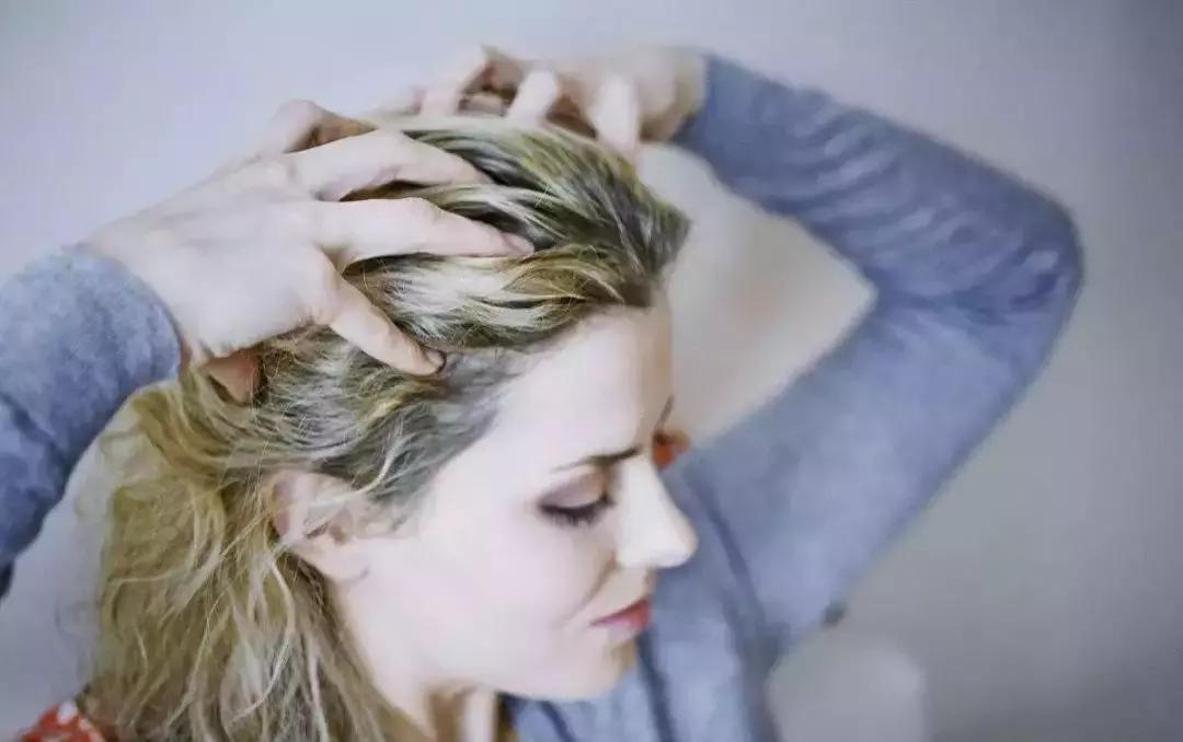 第一批90后已经秃了,第一批90后开始秃顶了