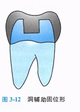 牙齿缺损修复去哪家牙科医院,牙科门牙缺损修复照片