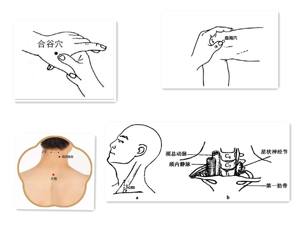 雷诺综合征的原因,雷诺综合症怎么得的