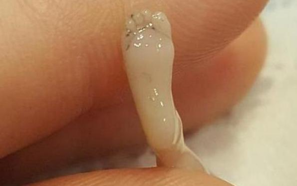 人工流产的胎儿怎么处置,人工流产的胎儿去哪了