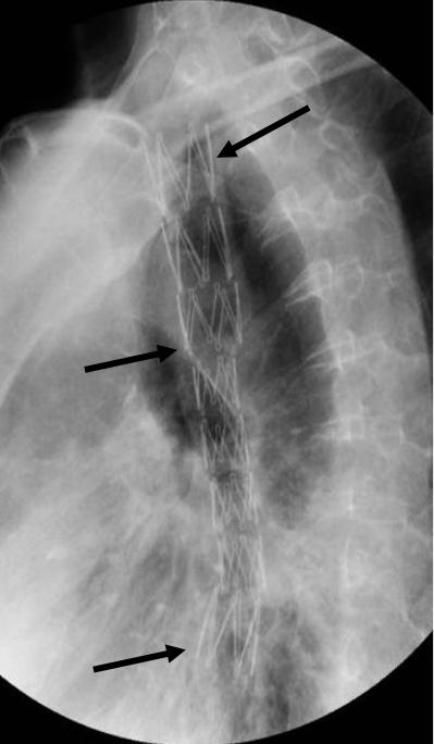 饥渴难耐却吞咽不下？吃货吃得停不下来？两个极端都可考虑请介入