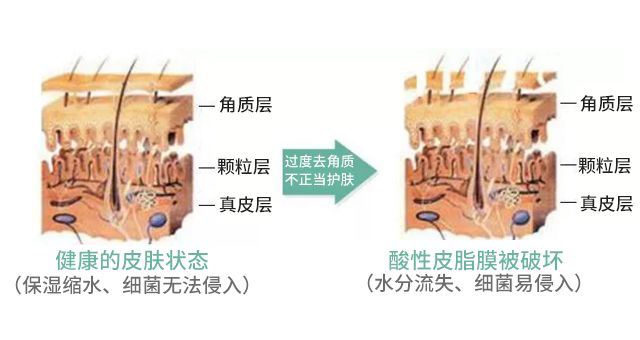 怎么样才能使角质层变薄,手部角质层变薄灼伤角质层