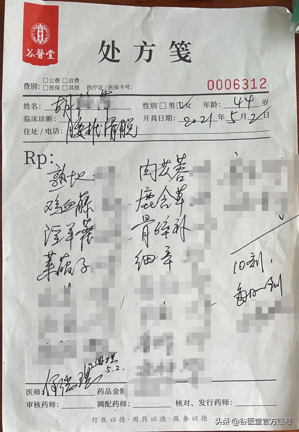 45岁女子得怪病,44岁女子身患系统性红斑狼疮