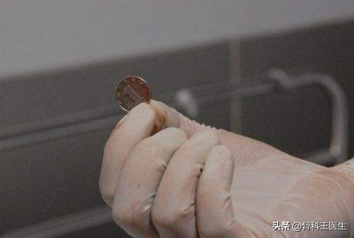 为什么有人会往直肠塞异物,为什么很多人都向直肠里塞异物