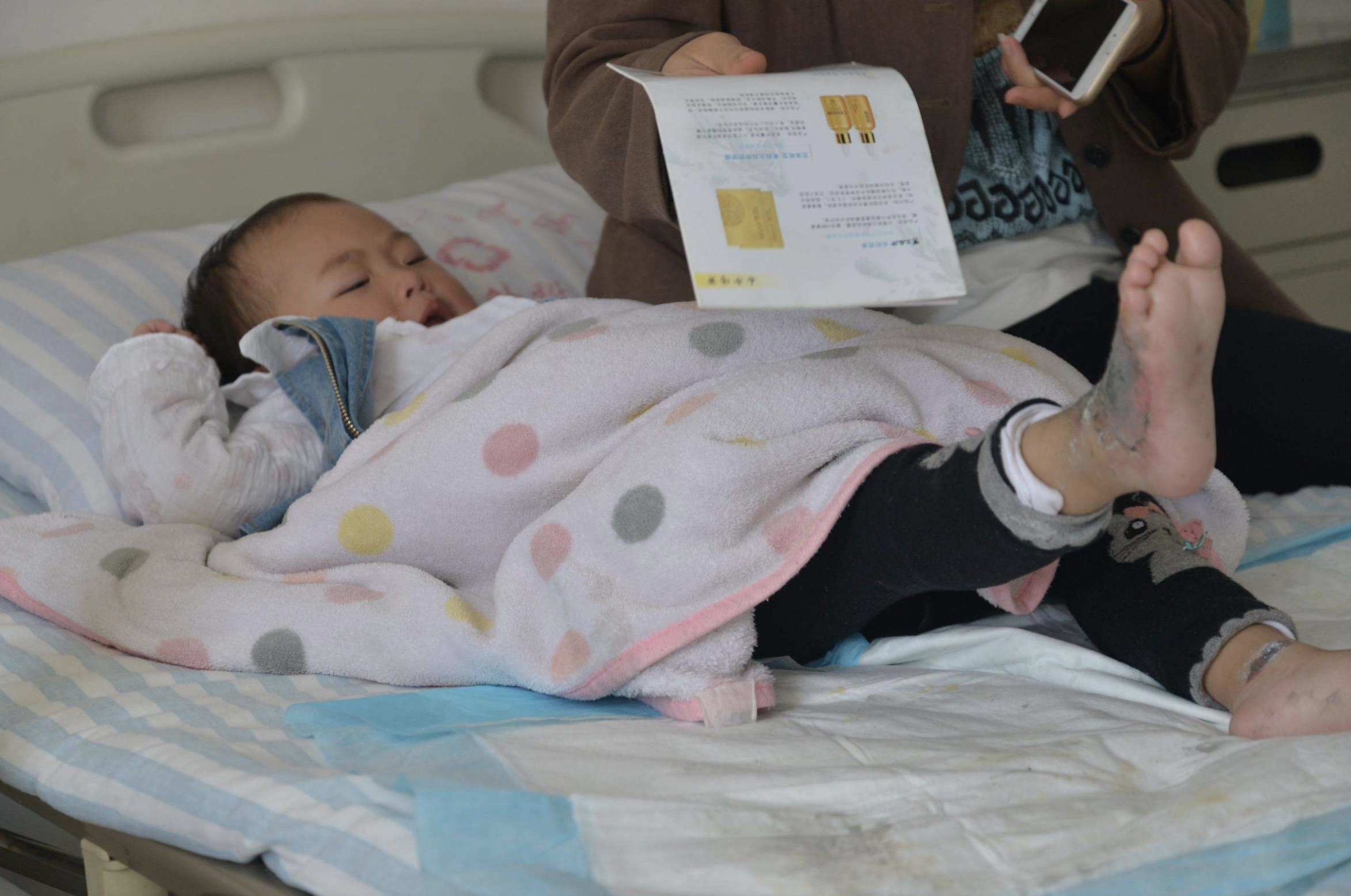 小孩烫伤后黄金一分钟处理方法,小孩烫伤后急救口诀