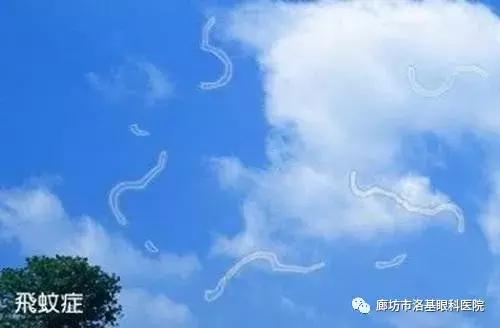 怎么判断是飞蚊症还是真的有蚊子,生活小妙招飞蚊症自愈的最佳方法