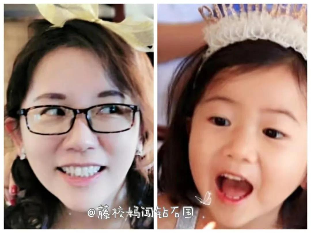 姚晨的牙齿怎么回事,姚晨育儿全过程