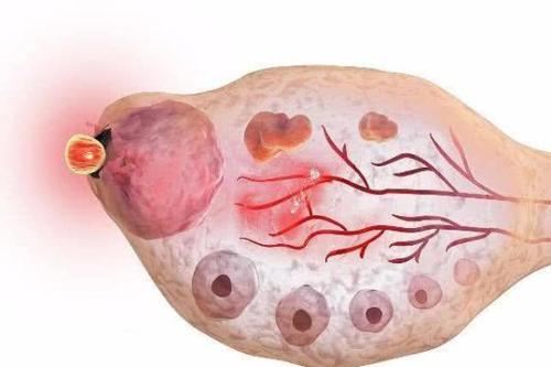 小腹疼还不是来月经是怎么回事,小腹偶尔疼痛但是不来月经