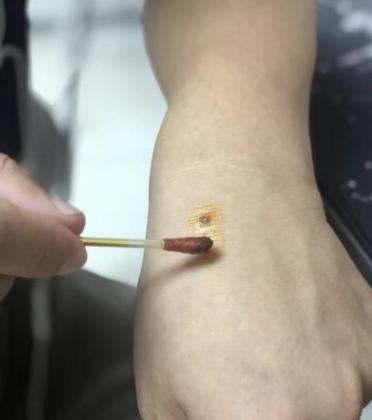 碘伏棉签，你的“family”备好了吗？