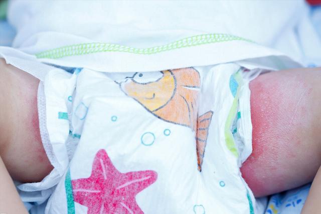 秋季宝宝护肤小技巧你get到了吗,宝宝秋季皮肤干燥用什么护肤品好