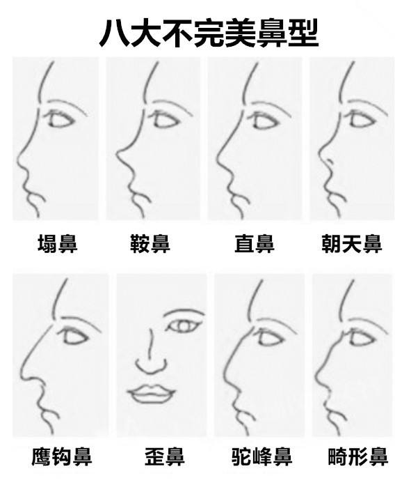 天生鼻型不完美怎么办呢,8种最丑鼻子合集
