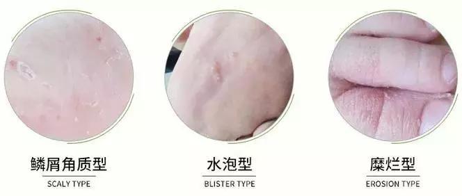 臭脚臭鞋袜不再尴尬，随身带瓶杀菌除味喷雾，轻轻一喷异味尽除