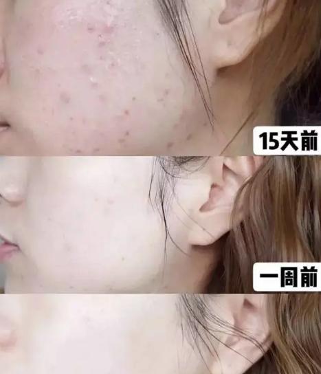 总算为国货争了口气，98.21%除螨率的洗面奶，张馨予也爱用