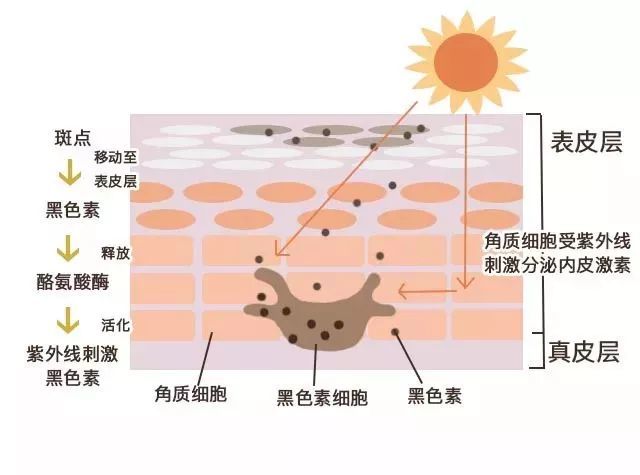 上眼皮黑眼圈是什么类型,黑眼圈的三种类型