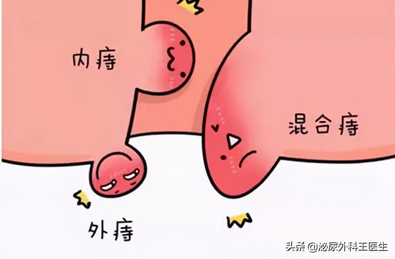 难以启齿的病是什么病,难以启齿的病症有哪些