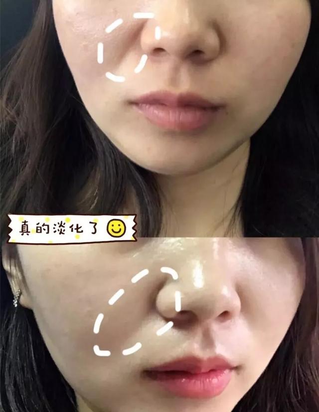 李佳琦伸手“护肤界”，安利这四款面霜平价又好用，太懂女人的心