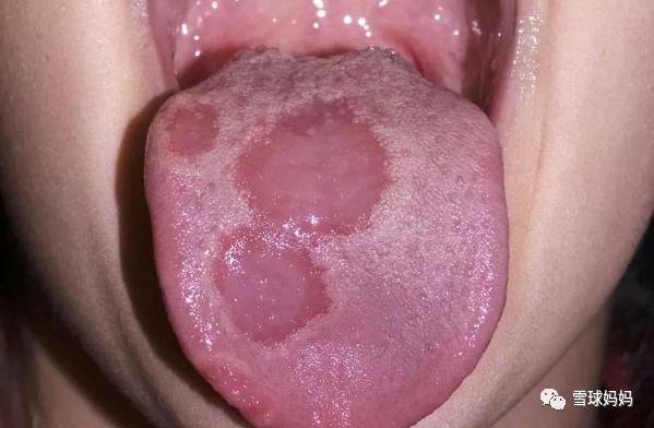 三岁孩子做根管治疗不配合,三岁小孩可以做根管治疗吗