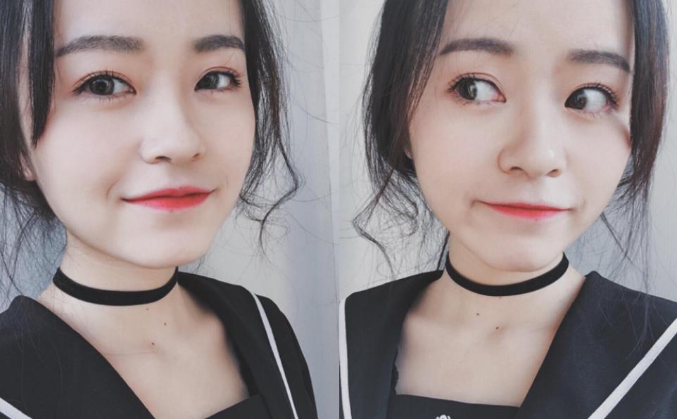 单眼皮如何变成大眼,单眼皮长期贴双眼皮会变双眼皮吗