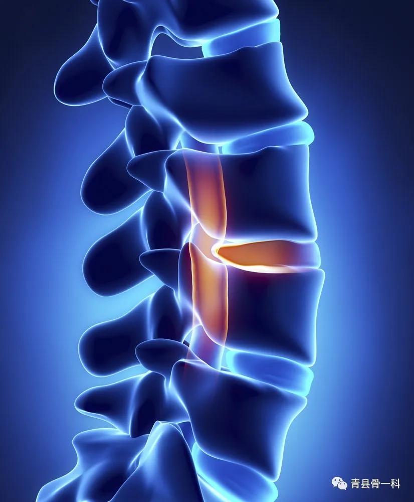 脊椎病有什么症状和表现,脊椎病有哪些明显症状