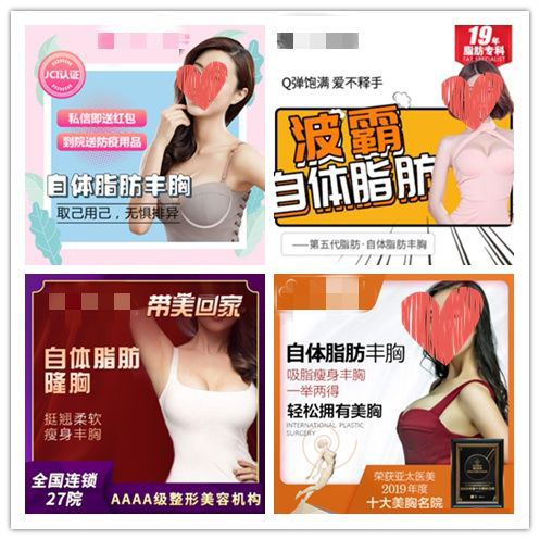 假体隆胸和自体脂肪隆胸是什么,自体脂肪隆胸怎么样