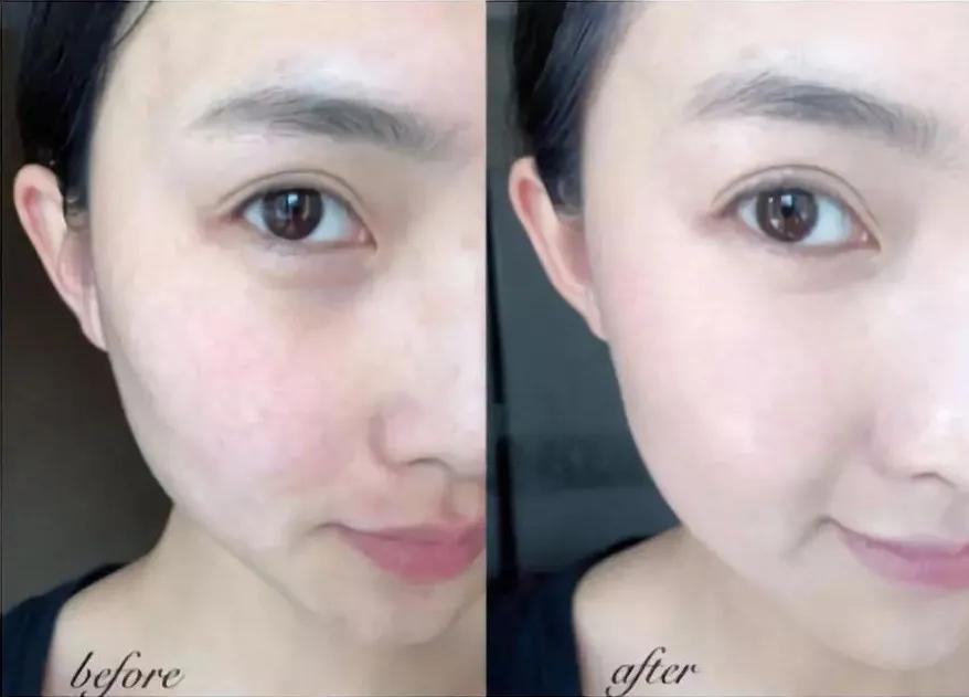 做医美的女生有多少,做医美的女生有什么特征