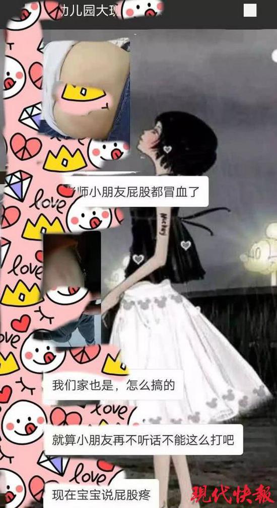 幼儿园学生被老师打的浑身淤青,5岁孩子17天被幼儿园老师打130次