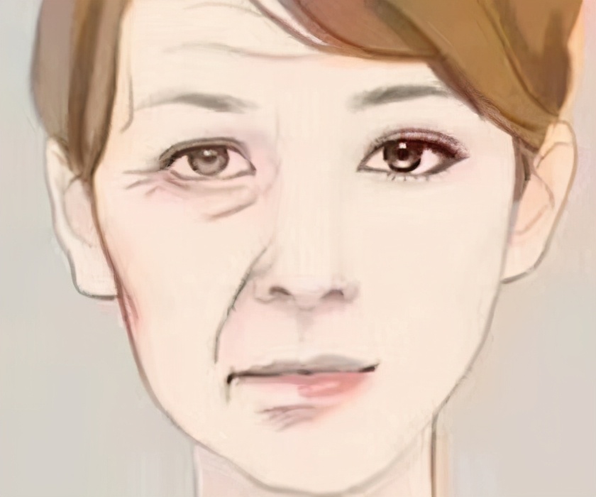 法令纹是什么怎么改善,为什么会有法令纹怎样才能消除