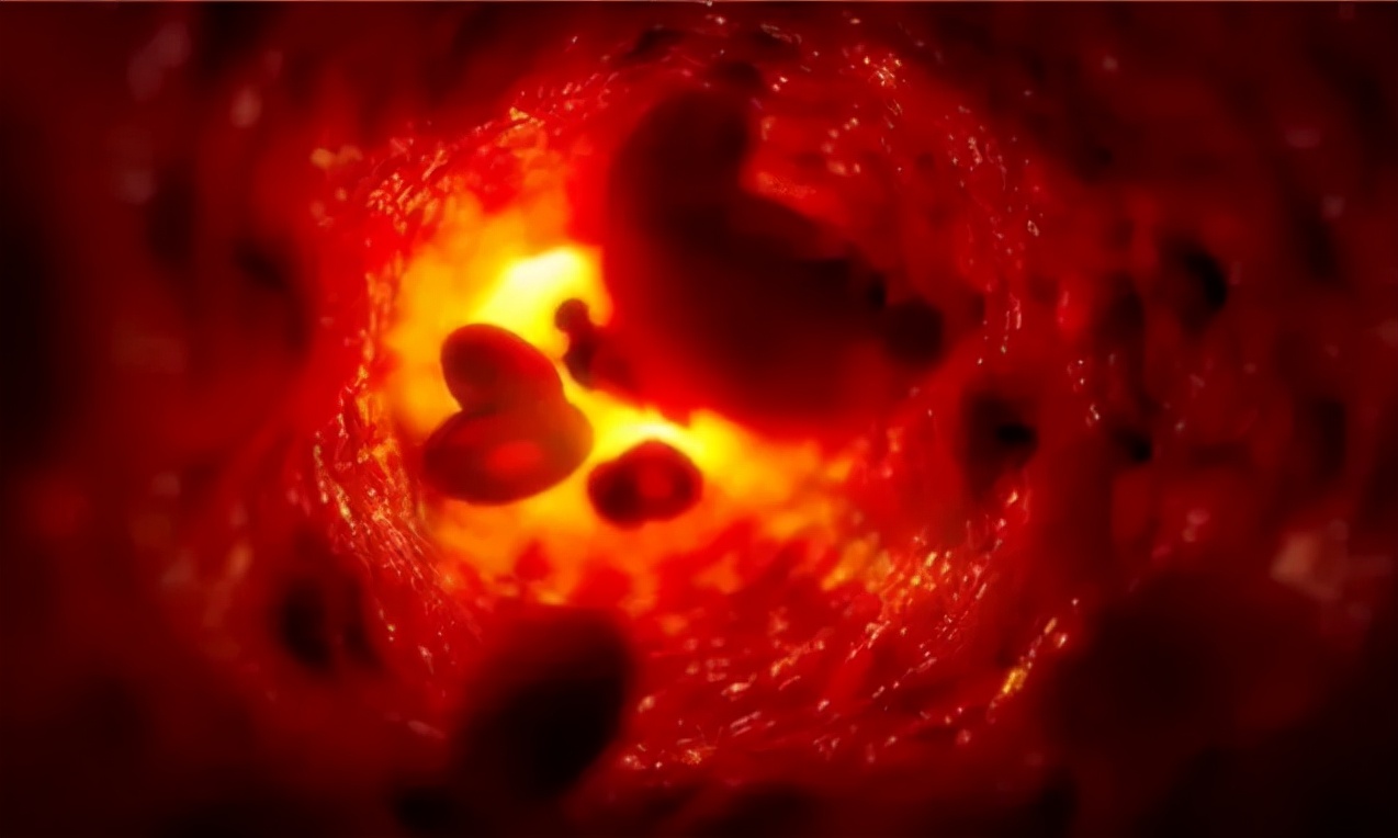 奖门人：几块钱一斤的它，可以防癌、降血糖，常吃还有减肥奇效