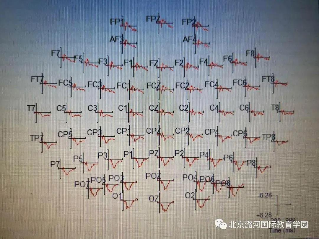 鍏ㄧ悆绗竴濂栫墝,涓栫晫绗竴浣嶈幏寰楀啲濂ヤ細閲戠墝鐨勪汉