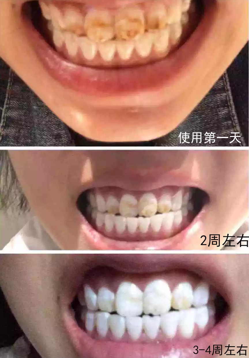 抽烟人的牙膏推荐,澳洲本命牙膏测评