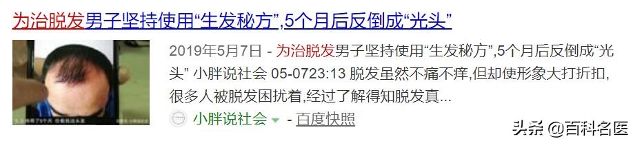 脱发严重怎样挽回发际线,发际线警告拯救脱发