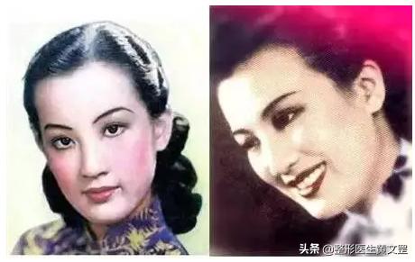 王世勇什么样的眼睛是美的,什么样子的眼睛才好看