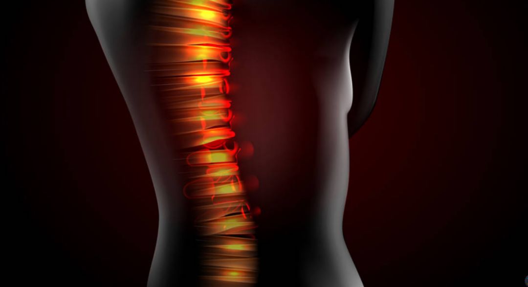 名中医强直,深圳治强直有名的老中医