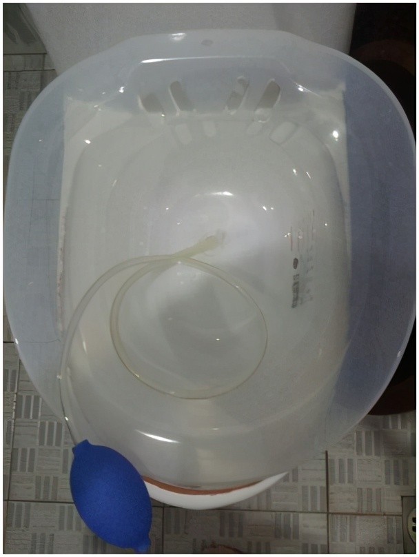 胡适怎么治疗痔疮,什么是痔疮