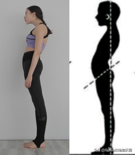 女人脖子后面的富贵包是什么原因,脖子后面有富贵包怎么让它消除